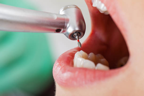 Best Emergency Broken Tooth Repair in Marine City, MI